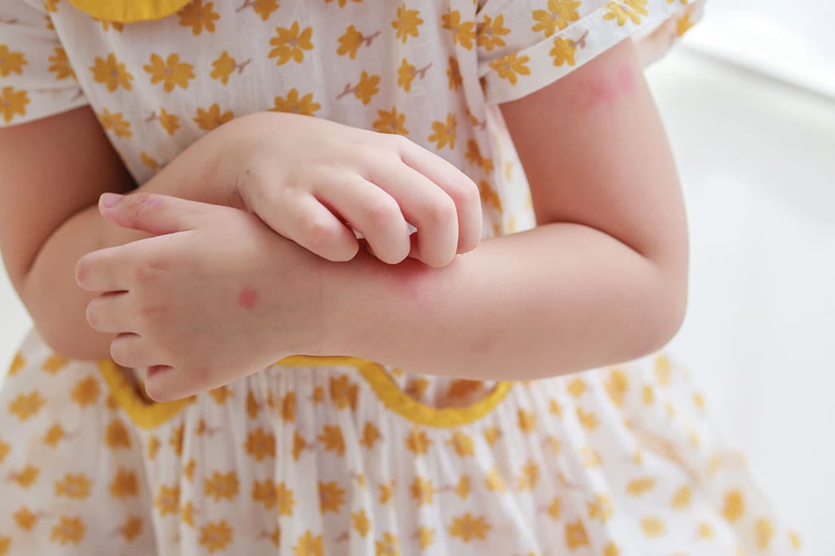 Kids with Malaria - Its a plus